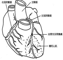 冠心病的病因是什么？