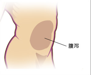 慢性腹泻怎么治疗最好