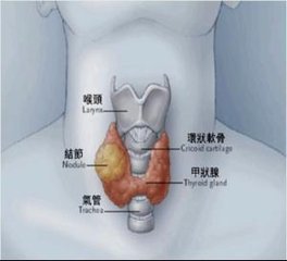 引发甲状腺结节的因素有哪些呢?