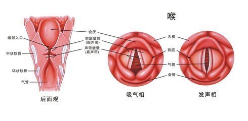 哪些人群易发慢性咽炎?