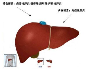 乙肝大三阳会不会传染？